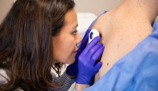 Dermatologen kunnen toestroom van patiënten niet meer aan: ‘Kom niet ieder jaar op controle’