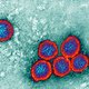 Eerste besmetting met westnijlvirus in Nederland
