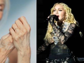“Veroudering tekent zich sneller af op de handen”: zo maak je niet dezelfde fout als Madonna