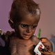 Vijf vragen over de grootste hongersnood van de eeuw: de humanitaire ramp in Jemen