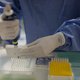 Is het zikavirus seksueel overdraagbaar? Twee gevallen baren zorgen
