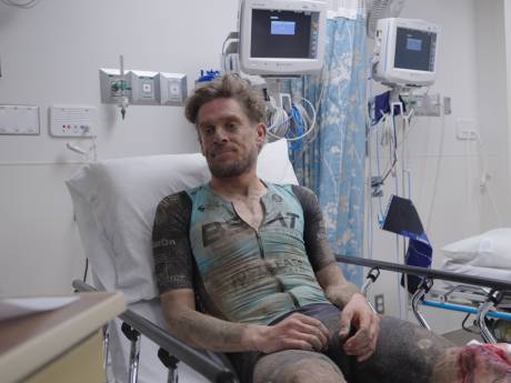 Gravelrace Unbound eindigt in drama voor Thijs Zonneveld: ‘Mijn knie ziet eruit als een vulkaankrater’