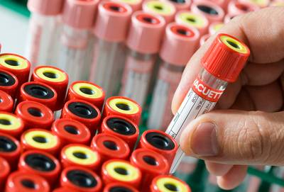 Arts (83) die patiënt eigen bloed in laat spuiten: briljant of gevaarlijk?