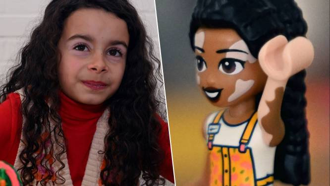 "Maman, regarde... C'est moi!": atteinte de vitiligo, Emily est devenue ambassadrice Lego Friends