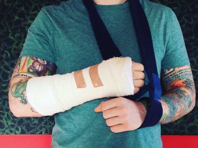 Ed Sheeran aangereden door wagen, gebroken arm brengt tour in gevaar