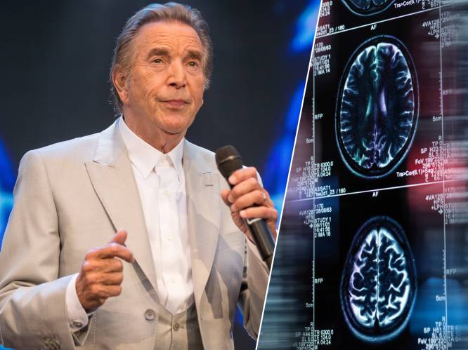 Hoe herken je alzheimer? “De ziekte is al tot 15 jaar aan de gang voordat je met klachten bij de dokter zit”