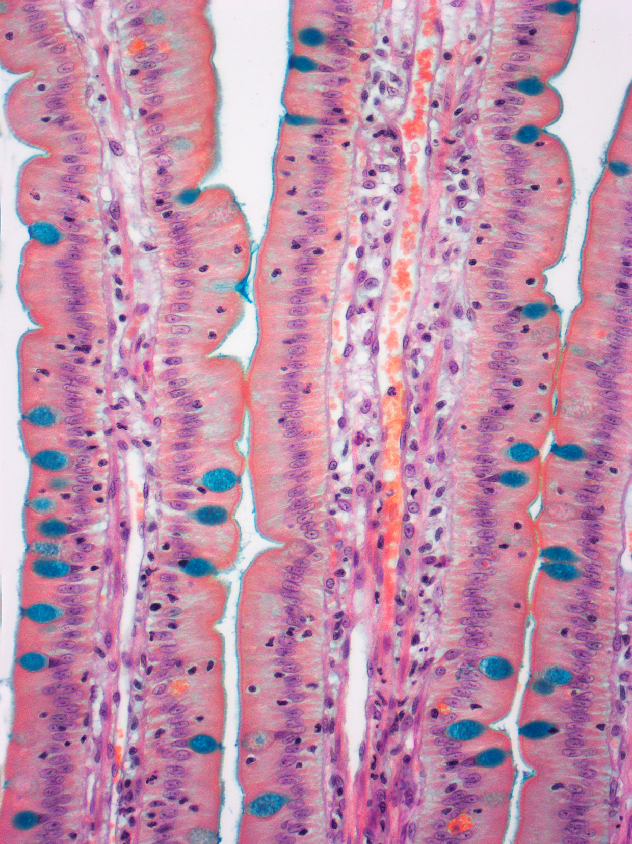 Beeld van de dunne darm door een microscoop Beeld Getty Images/Science Photo Libra