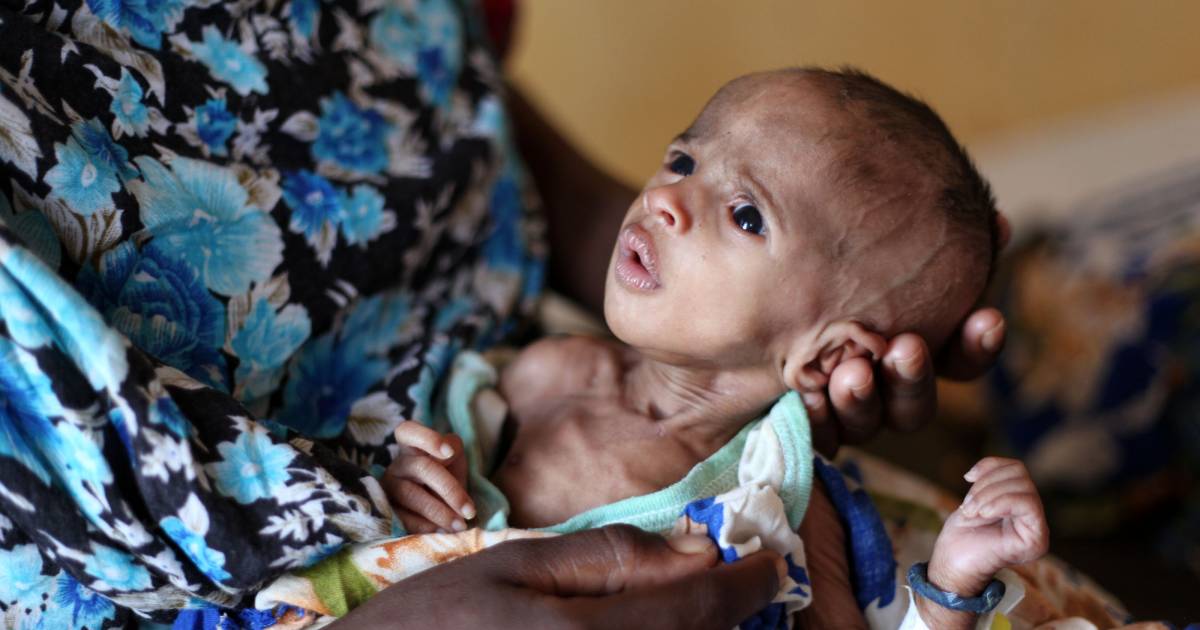 Più del doppio delle persone che soffrono la fame in Africa orientale: ‘Una palese mancanza di coraggio politico’ |  all’estero