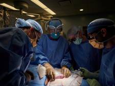 Un rein de porc transplanté pour la première fois sur l'homme