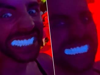 Man gaat viraal nadat hij tanden laat bleken, effect wordt pas duidelijk in nachtclub