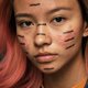 ‘Puistjes zijn in’: de opkomst van acne positivity