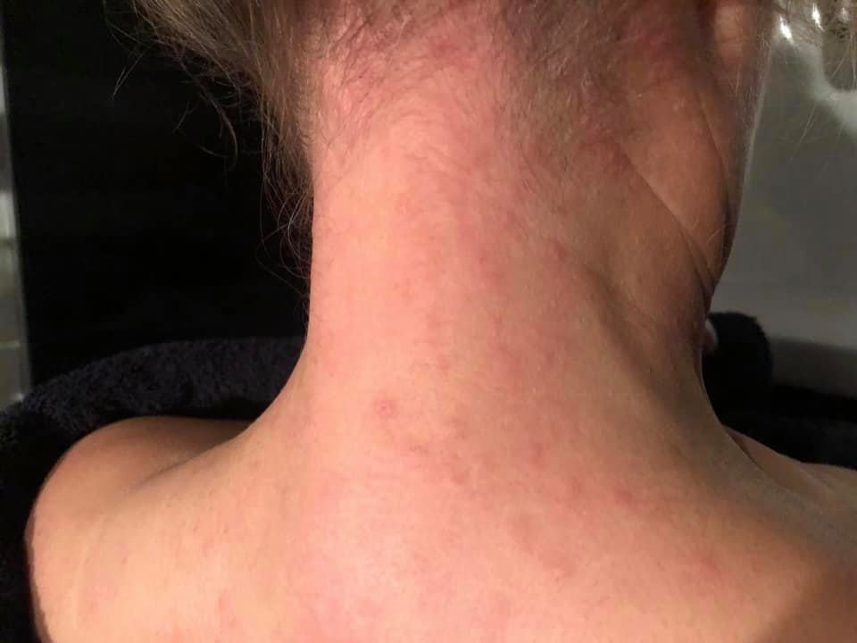 Tips van ervaringsdeskundigen dit doen mensen