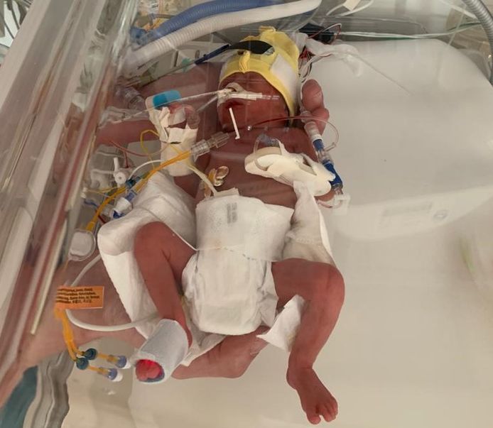 Yula Langelaar twee dagen oud op de NICU van het WKZ.