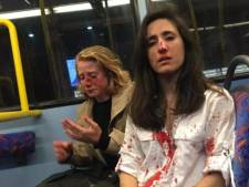 Une hôtesse de l’air et son amie tabassées dans le bus car elles refusent de s’embrasser