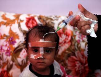 Acute ondervoeding bij kinderen op hoogste niveau ooit in Jemen