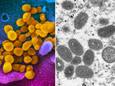 Links een foto van het coronavirus onder een microscoop, rechts een foto van het apenpokkenvirus.