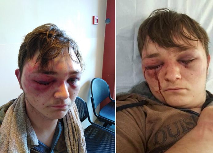 Dans la nuit du 24 au 25 juin 2019, Dorian a été séquestré, torturé et presque violé.