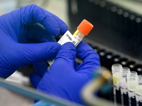 Omicron représente 60% des infections au coronavirus en Belgique