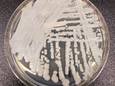 De candida auris, via CDC.