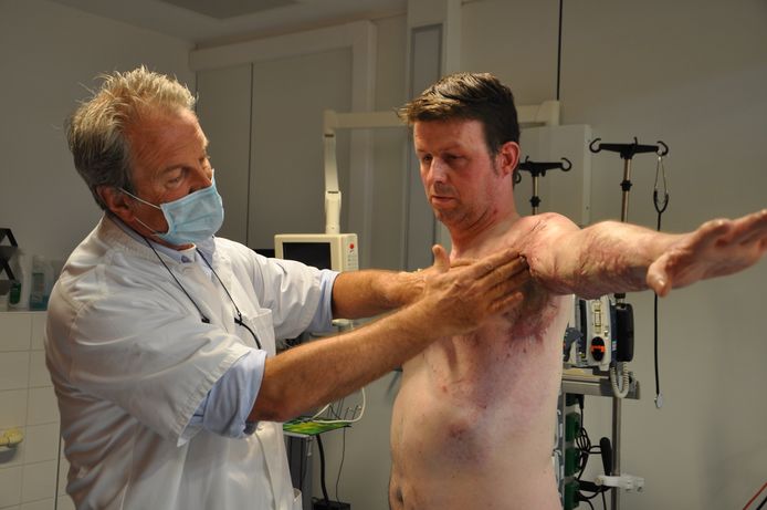 Tom Vanheule liep zware brandwonden op aan zijn bovenlijf na een ongeval met een cowboysteak. Hier wordt hij onderzocht door dokter Stan Monstrey van UZ Gent.