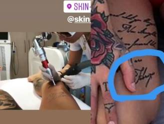 Liet Pommeline de tatoeage van Fabrizio verwijderen?