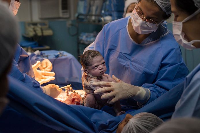 A sa naissance, ce bébé lance un regard noir et fait le buzz