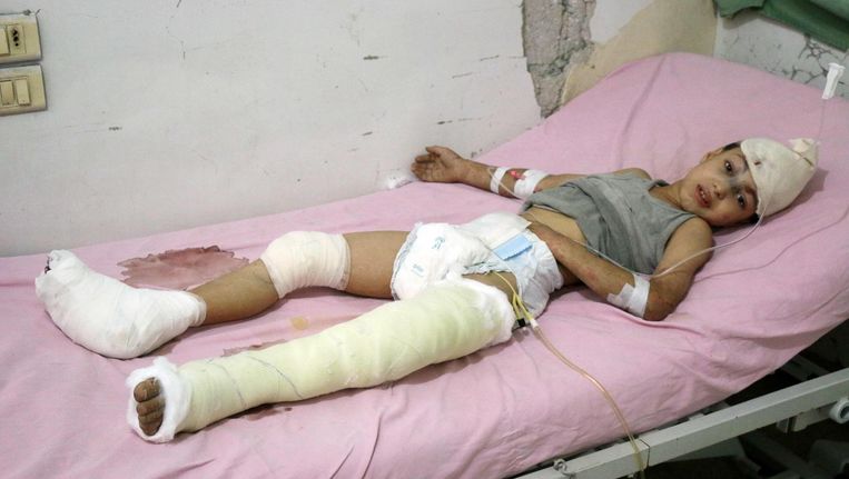 Een 9-jarige jongen die gewond raakte door een Russische luchtaanval. Beeld afp