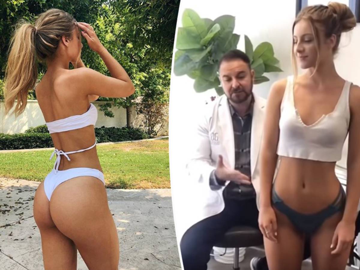 VIDEO. Instagrammodel krijgt constant verwijt dat billen niet echt zijn.  Dokter velt nu zijn oordeel | Buitenland | hln.be