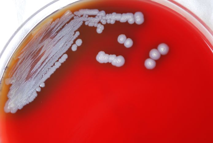 De bovenstaande foto van de Amerikaanse gezondheidsautoriteit CDC toont verschillende "kolonies" van de 'Burkholderia pseudomallei'-bacterie.