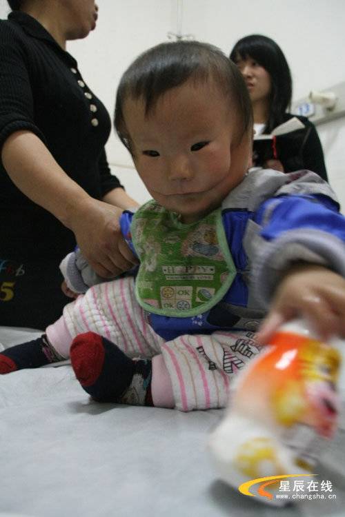Un Bebe Ne Avec Un Masque Sur Le Visage Video Insolite 7sur7 Be