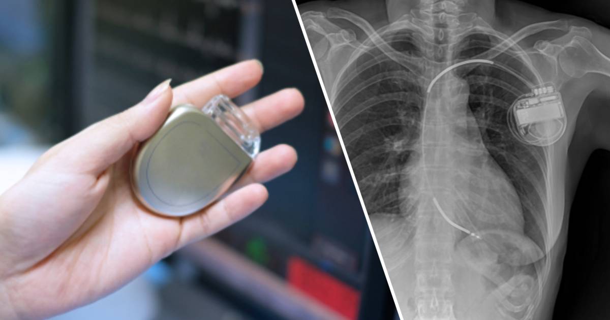 Hoe werkt een defibrillator en kan je ermee sporten op hoog niveau? “Het is een engelbewaarder