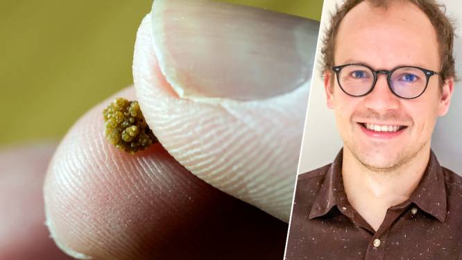 “1 op de 10 Belgen krijgt ooit last van nierstenen”: hoe herken je ze en kan je ze voorkomen? 