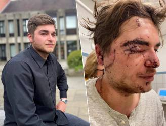 Man die Sam (25) lelijk toetakelde met gebroken glas in uitgaansbuurt kent zijn straf: 40 maanden effectief