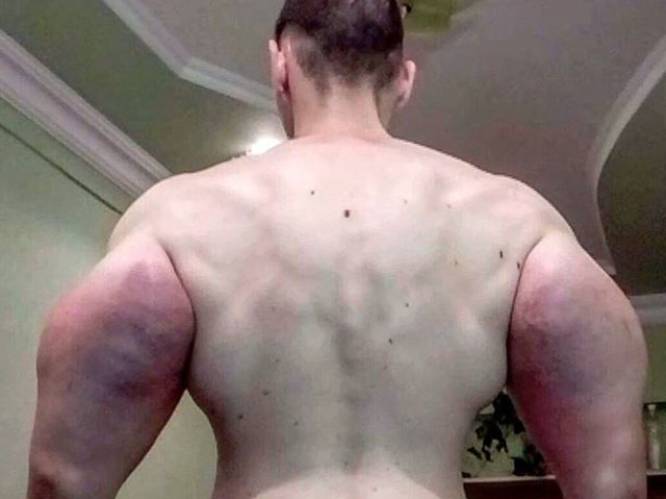 Rus kweekt enorme spieren zonder ooit naar de fitness te gaan
