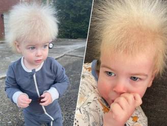 “Ik dacht eerst dat er iets mis was”: moeder deelt foto’s van zoontje met onhandelbaar haarsyndroom