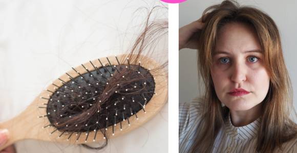 UITGETEST. Je eigen bloed gebruiken tegen haarverlies. “Ik ben aangenaam verrast als ik na enkele weken een verschil merk”
