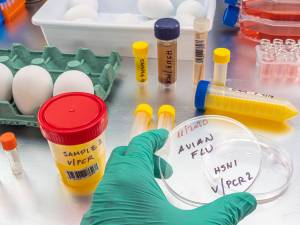 L’OMS fait part de son “énorme inquiétude” face à la transmission de la grippe aviaire H5N1 à l’homme