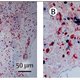 Onderzoek: coronavirus slaat ook hard toe in het brein
