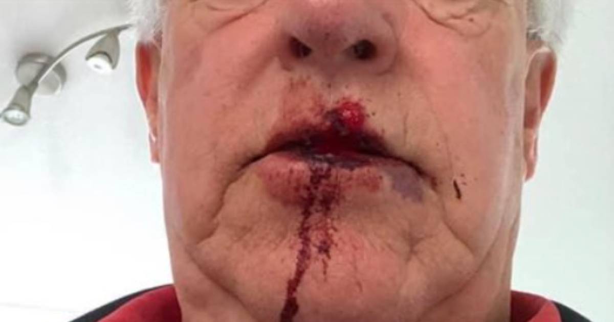 Man (75) geslagen door wielrenner, politie op zoek naar de dader.