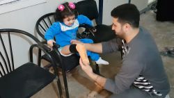 Syrisch meisje (3) dolblij met nieuwe prothese