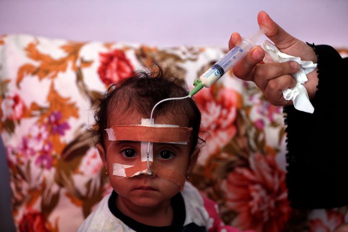 Een Jemenitische vrouw geeft haar ondervoed kind voeding via een buisje, beeld uit een ziekenhuis gesteund door de Verenigde Naties in Sanaa.