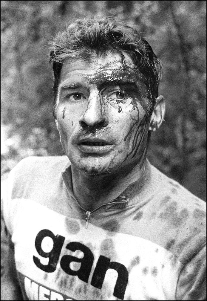 Na zijn val in de 13e etappe van de Tour 1973.