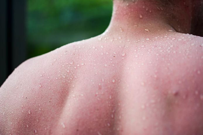 Foto ter illustratie.