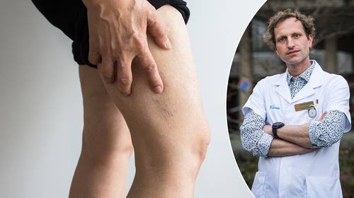 Na alle drukte over trombose: cardioloog over hoe je de symptomen herkent