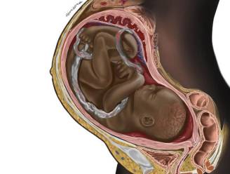 Tekening van zwarte foetus gaat viraal. “We moeten lesmateriaal van studenten meer afstemmen op de praktijk”