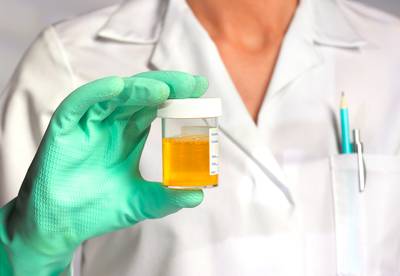 “Zuivere urine stinkt niet, tenzij het bacteriën bevat”: wat zegt jouw urine over je gezondheid?