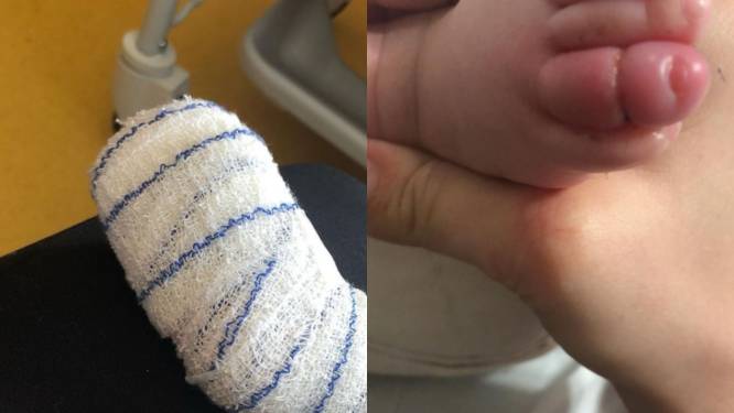 Un Medecin A Utilise Six Fois Une Ventouse Pour Accoucher Un Bebe Il Sera Juge Pour Homicide Involontaire Belgique 7sur7 Be