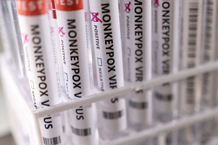 Testtubes van positieve gevallen van het apenpokkenvirus.
