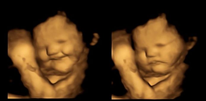 Links de uitdrukking van de ongeboren baby nadat de moeder wortelen had gegeten, rechts een foetus met een neutrale expressie.