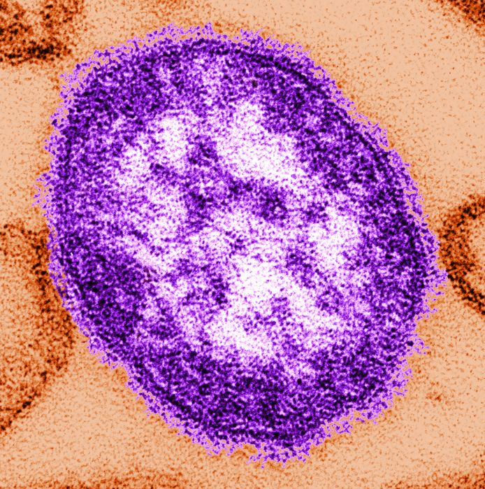 Het mazelenvirus is een van de meest besmettelijke virussen ter wereld.